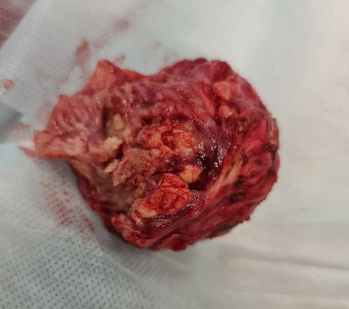 А вот это поехало на гистологию.