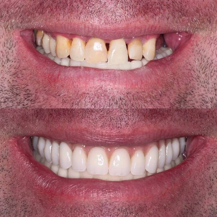 �� ���������� - ���� �������� ��������! ��������� ������� ������� �� ������� ����