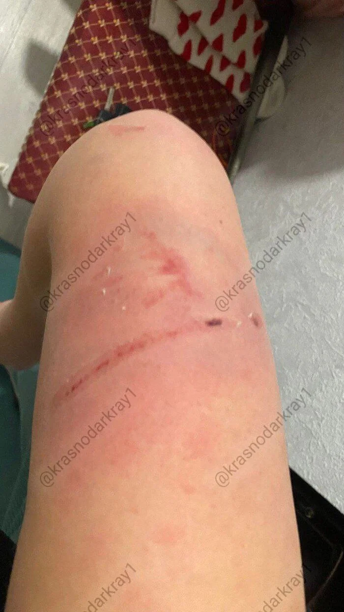 Post #12135079 - Dog attack, Dog lovers, Fine, Dog, Pitbull, No muzzle, Krasnodar, Negative, Incident, Fighting dog, Video, Soundless, Vertical video, Telegram (link), Longpost