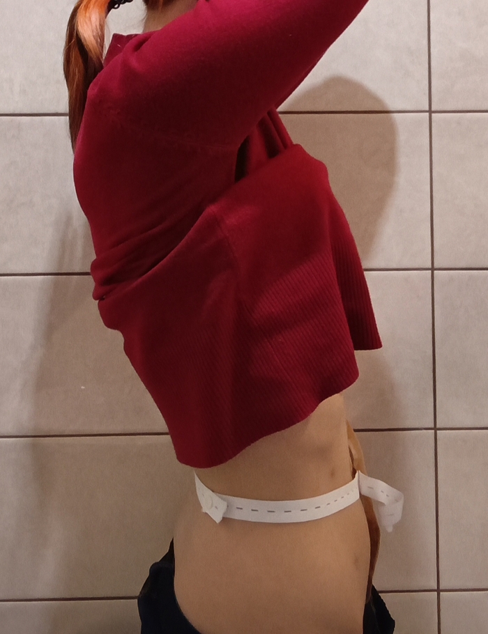 Надеюсь набрать вес через год. Я 6-7кг после операции потеряла. Охуел от впалого на тот момент живота. Руки и ноги ваще как спички, чего я не замечала раньше и пыталась похудеть. Т е кишка была раздута настолько, что живот выпирал, и это при худобе