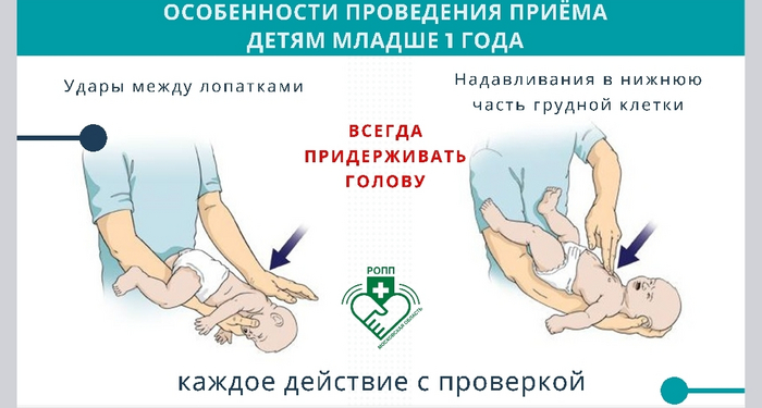 Инородное тело верхних дыхательных путей у детей до года