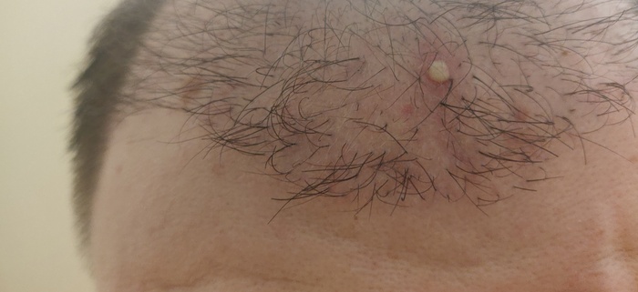 один из примеров