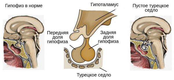 Reply to post Cowgirl - Anatomy, The medicine, Reply to post