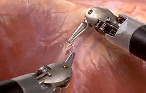 Хирургические инструменты робота «Да Винчи»