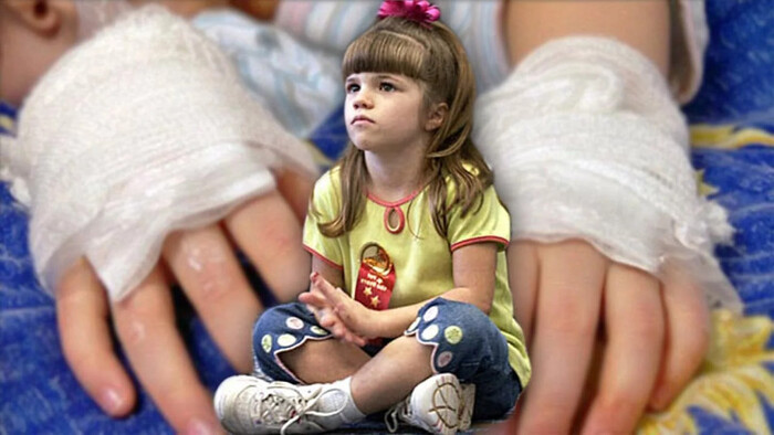 Девочка, которая не чувствует боли