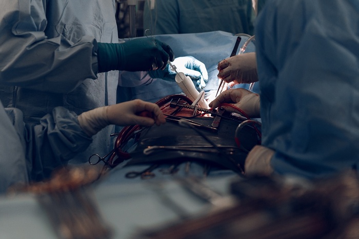 ������������� ������������� ������ �� ������� ����� ��������, ��������� 150 �����������