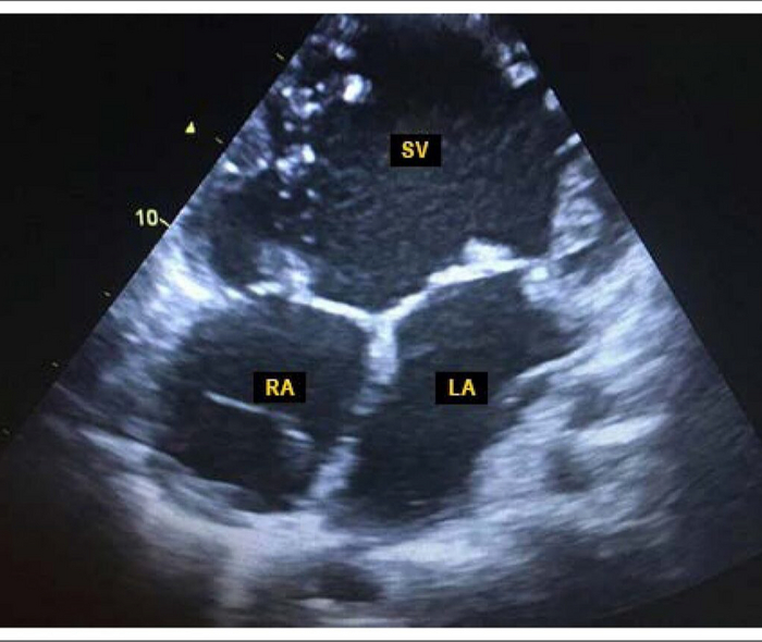 "3- "  . RA LA -    ,       .