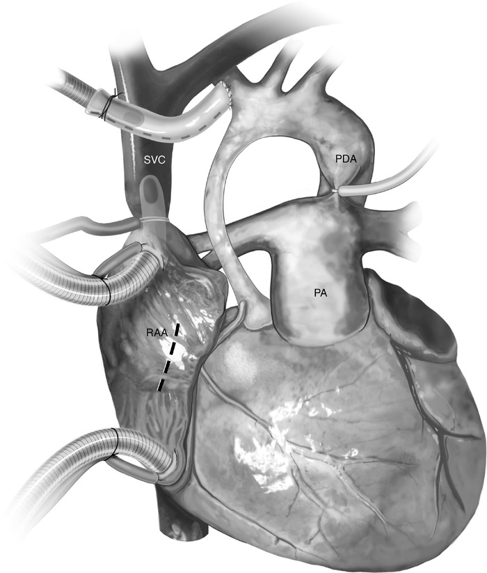    .      (  PA -  ),    .