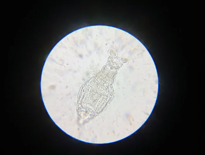 Unexpected neighbors - My, Microscope, Microscopy, Video, Soundless, Short videos, Longpost