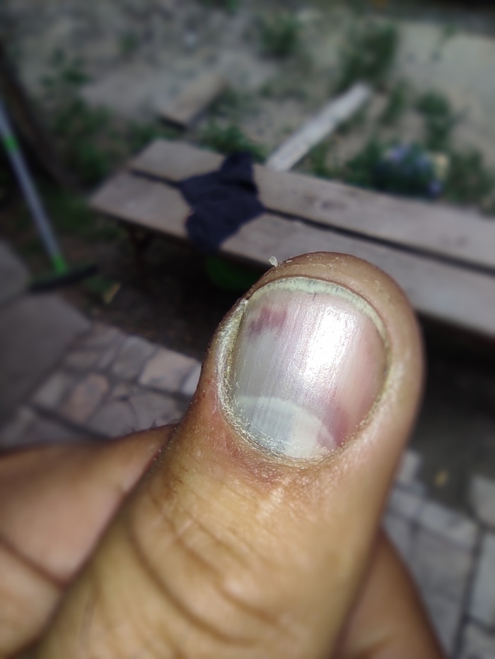 �� ������� �� �������.