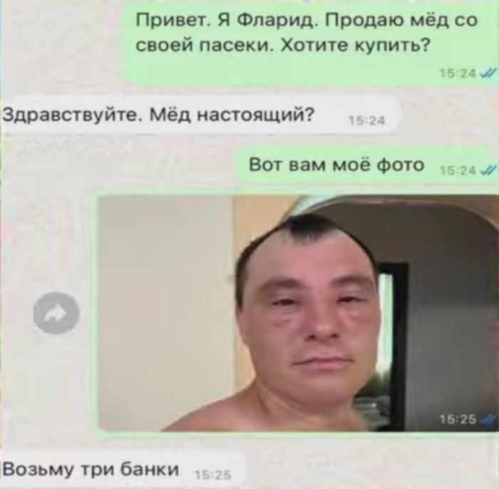 Производственные травмы