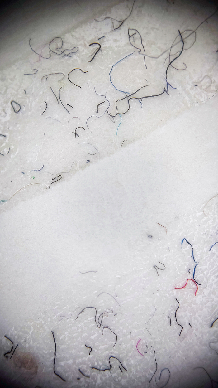 Видно и частички тканей и клей