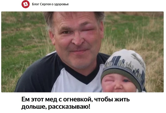 Ответ на пост «Производственные травмы»