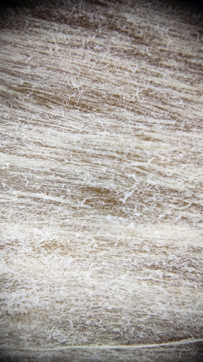 Перепонки на дольках