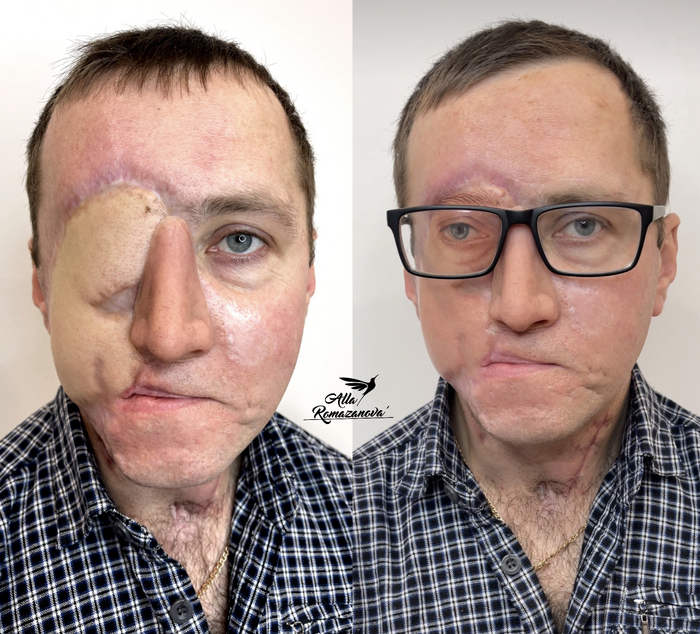 До и После, история сильного мужчины и сложной работы