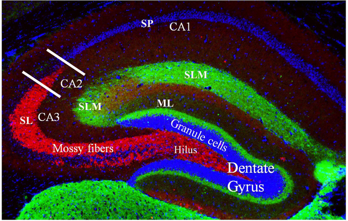 <a href="https://pikabu.ru/story/pravda_li_chto_kogda_zhivotnyie_vo_sne_dyorgayut_lapkami_im_snitsya_okhota_ili_igra_12331511?u=https%3A%2F%2Fwww.cell.com%2Fneuron%2Ffulltext%2FS0896-6273%2821%2900651-6%3F_returnURL%3Dhttps%3A%2F%2Flinkinghub.elsevier.com%2Fretrieve%2Fpii%2FS0896627321006516%3Fshowall%3Dtrue&t=%D0%98%D1%81%D1%82%D0%BE%D1%87%D0%BD%D0%B8%D0%BA&h=efac2cac6d2a214cc01fa6739e539798b5d75808" title="https://www.cell.com/neuron/fulltext/S0896-6273(21)00651-6?_returnURL=https://linkinghub.elsevier.co..." target="_blank" rel="nofollow noopener">��������</a>