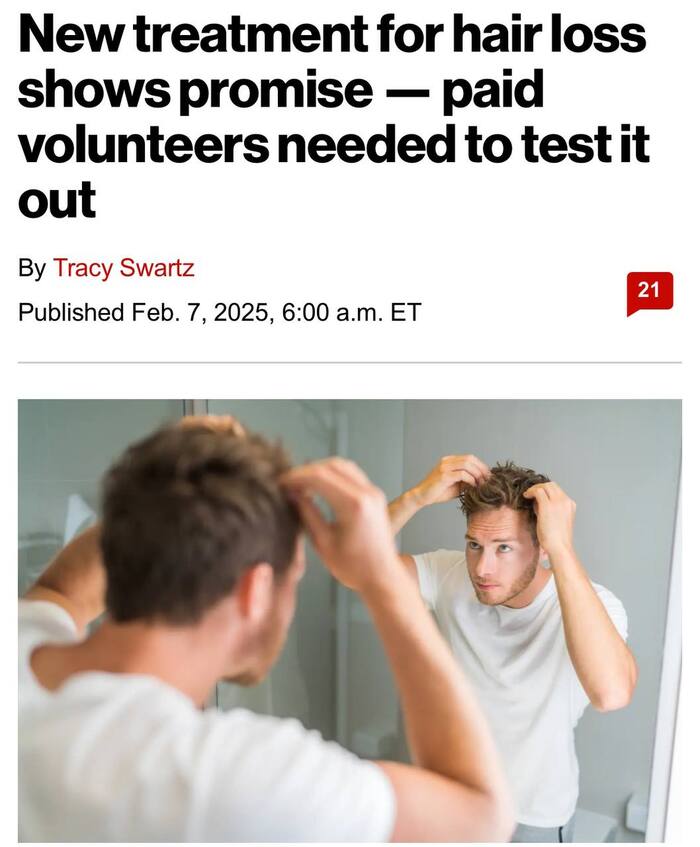 Облысение - В С Ё!