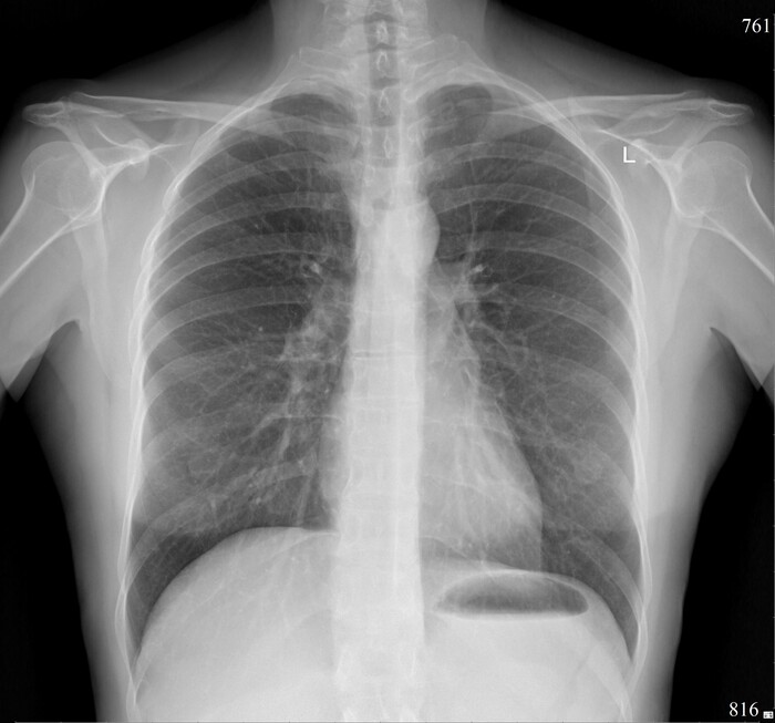 ����� �� �������������� ���