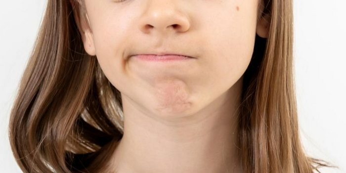 "Ухмылка влево" из упражнения "Улыбка"