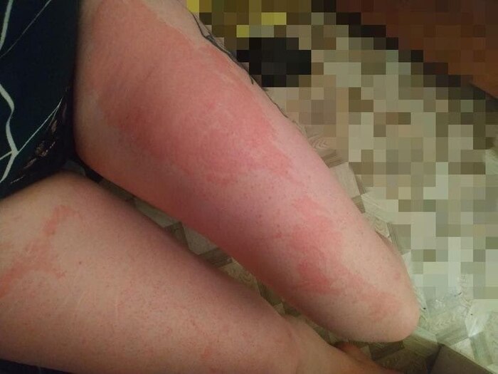 Девочки подскажите пожалуйста, что это может быть? Депиляция была воском