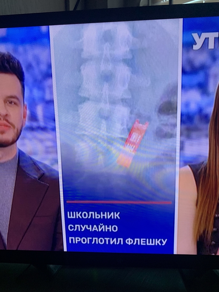 Рентген цветной