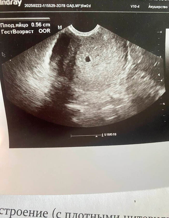 Много лет пытались с женой завести ребёнка. Вчера принесла такое фото! Попробуйте переплюнуть этот подарок на 23 февраля ;)