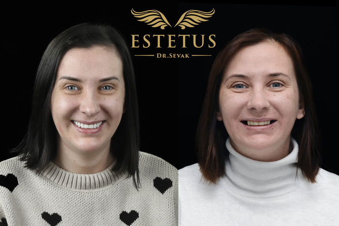 ���� �����������-�������, ������������ �������� ������ �������������