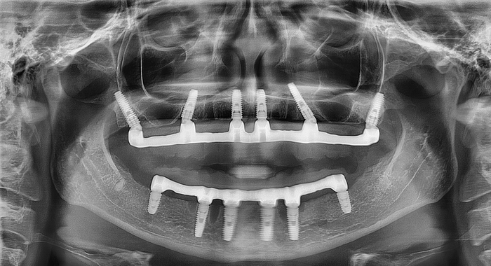 ���� �����������-�������, ������������ �������� ������ �������������