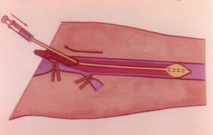     ,           ,   ,     . 