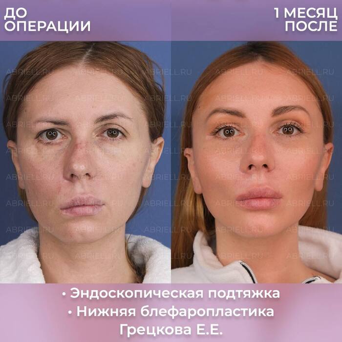    @dr_gretskova , Pikabu Publish Bot, , Telegram ()