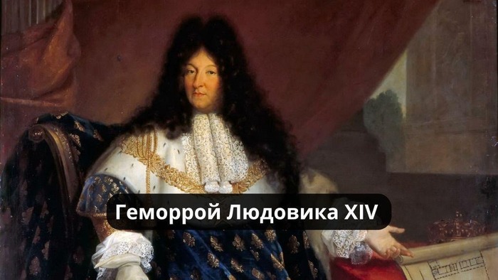   XIV:      XIV, , , , , , , , ,  , ,  , , , ,  , 