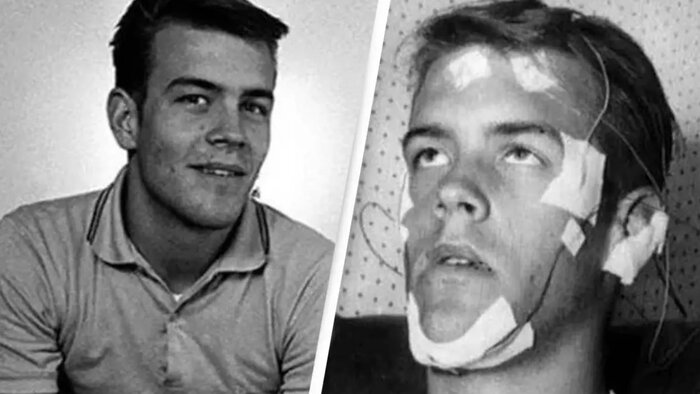 Рэнди до эксперимента и в самый его разгар