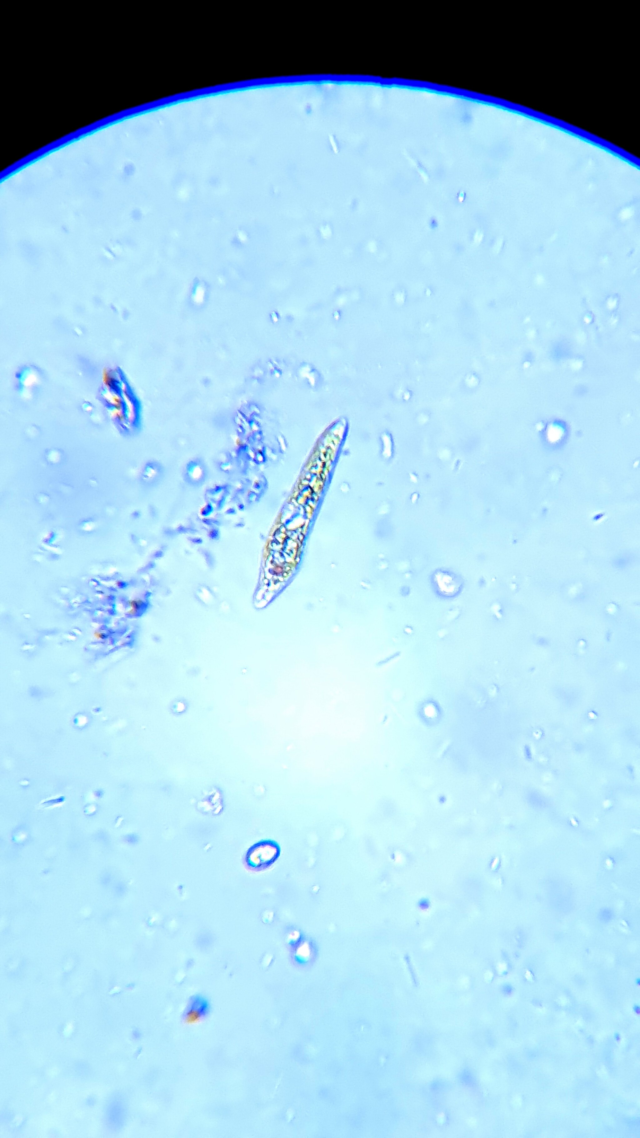 Got interested in microscopy - My, Microscopy, Microscope, Euglena green, Video, Youtube, Longpost