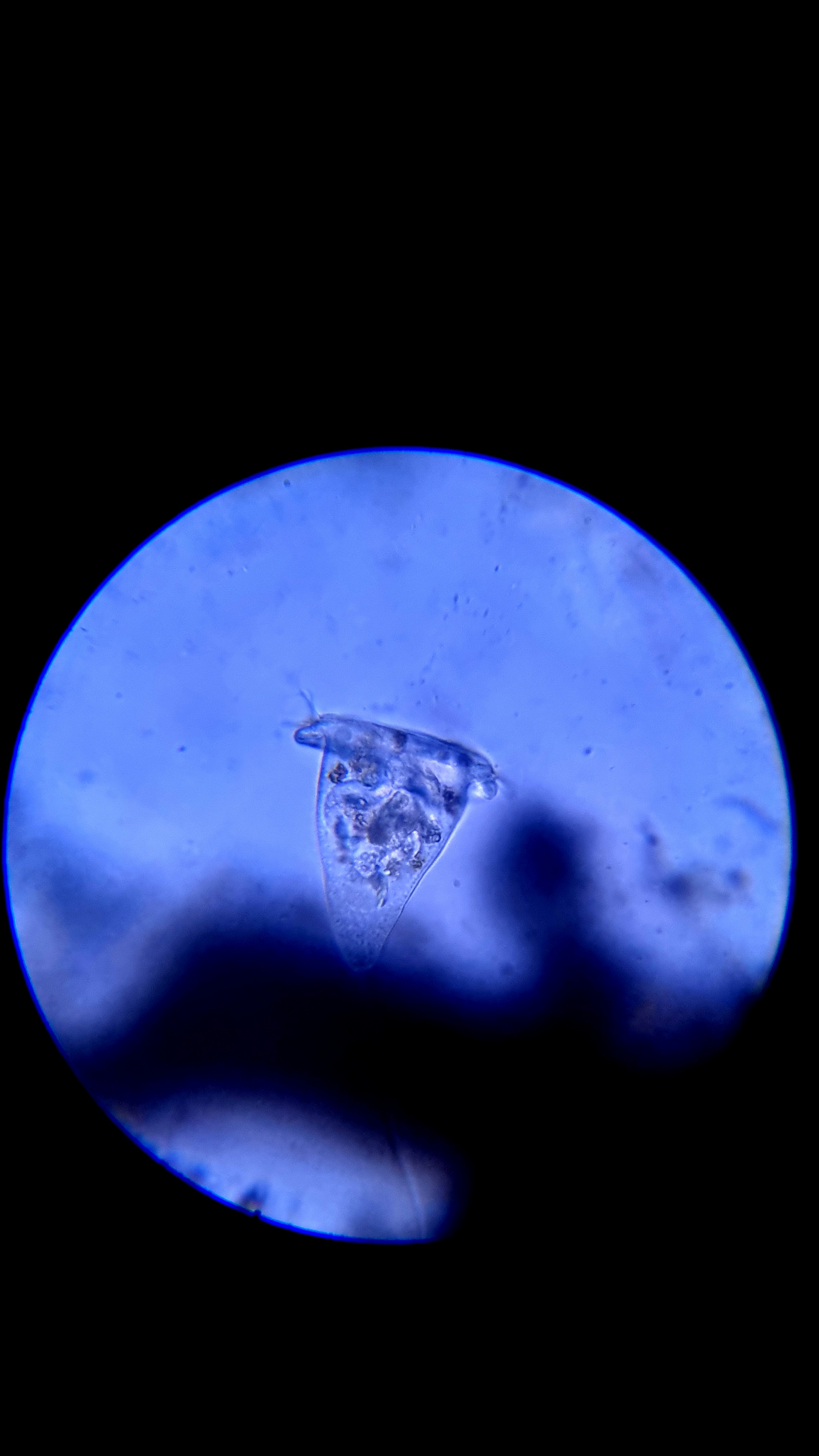 Garden sap under a microscope - My, Microscope, Microscopy, Nauchpop, Video, Youtube, Longpost