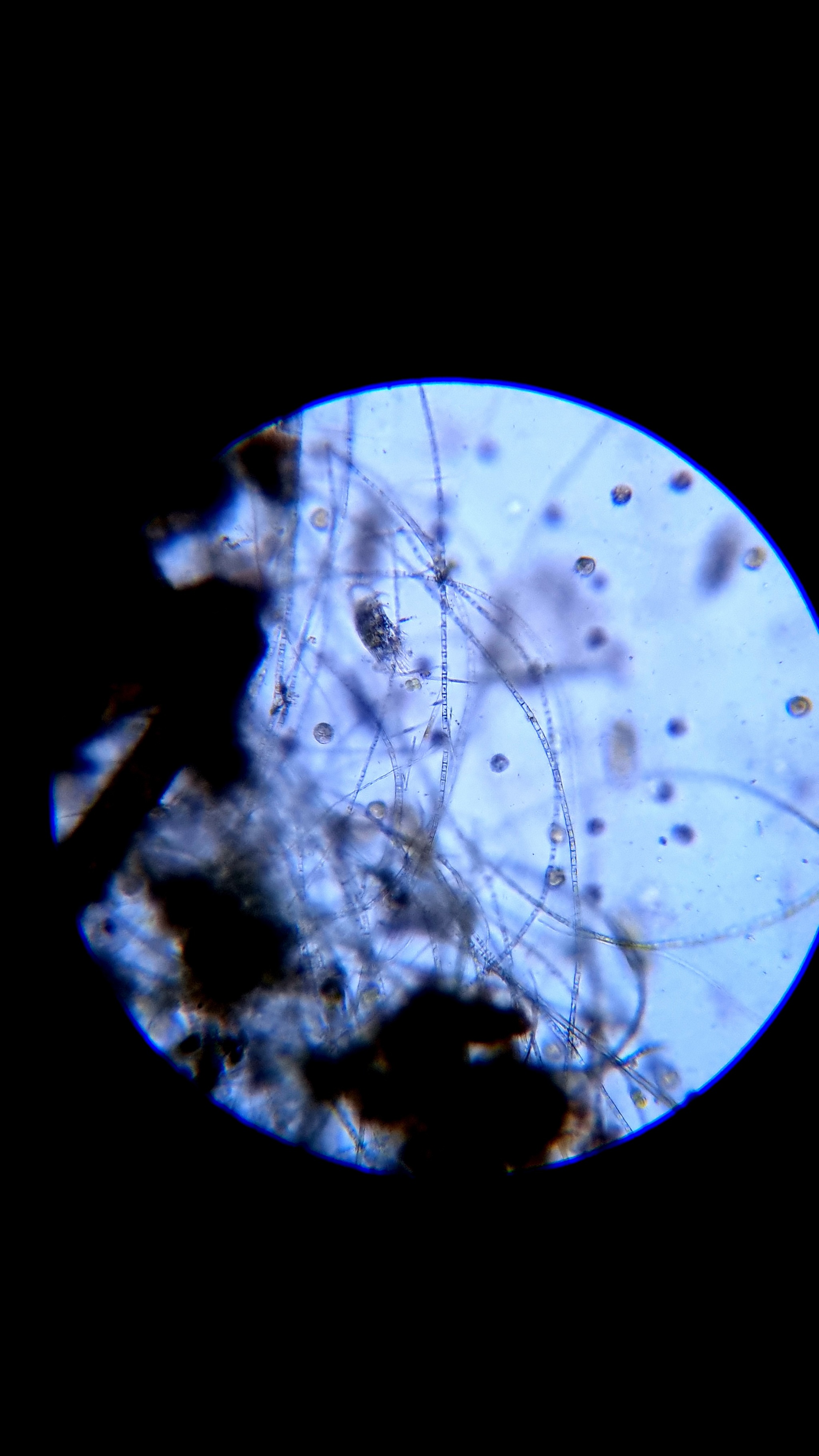 Halteria ciliates in water for irrigation - My, Microscope, Nauchpop, Microscopy, Video, Youtube, Longpost