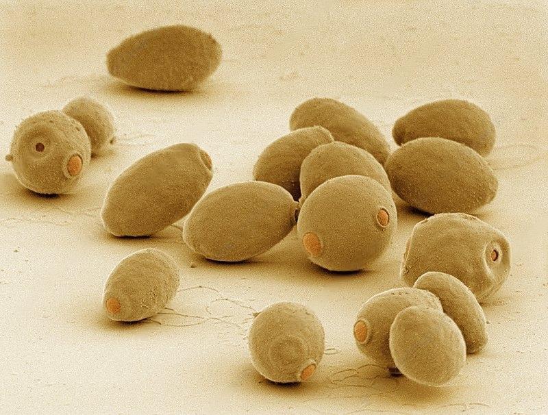 Is yeast the food of the future? - My, Research, Nauchpop, Biology, Scientists, The science, Video, Video VK, Longpost