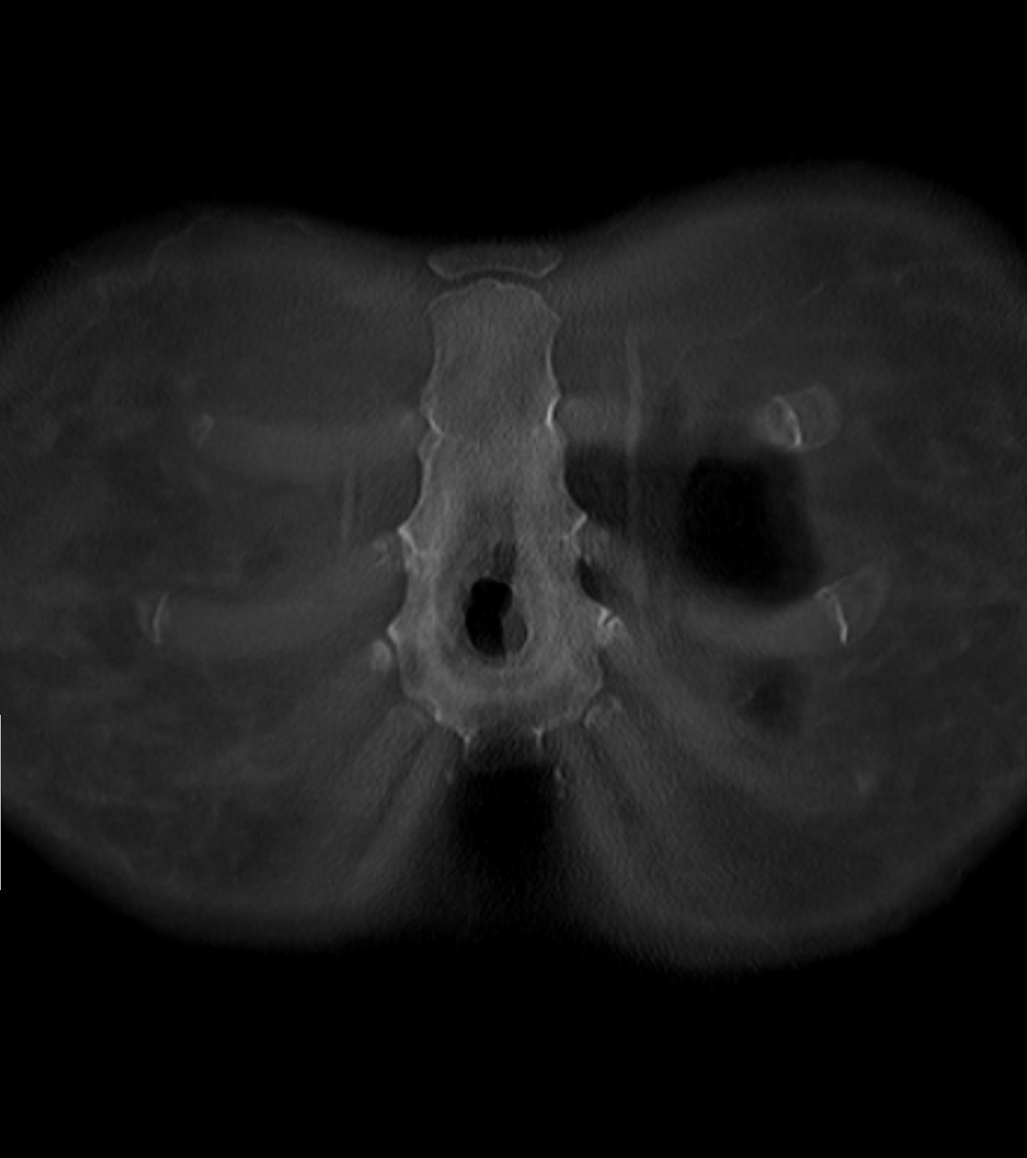 Case Studies: A Chink in the Armor - My, The medicine, Personal experience, This is the norm, Bones, CT, Radiology, Radiologist, Longpost