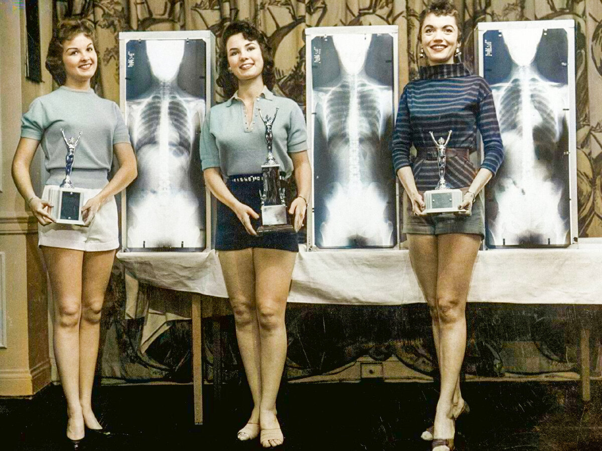 Miss Sausage or the strangest beauty contests of the last century. 15 colorized photographs - My, Old photo, Colorization, Historical photo, The photo, Beauty contest, Longpost