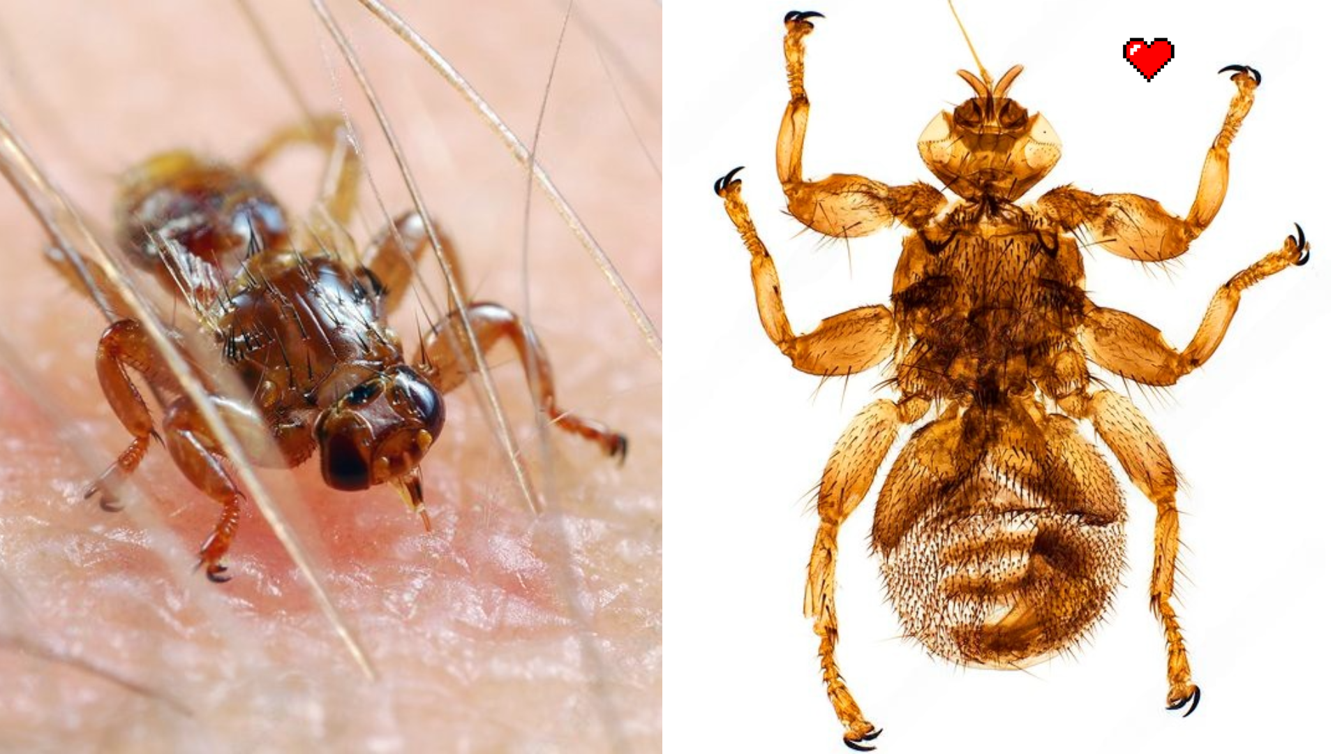 Deer bloodsucker (flying tick) under a microscope - My, Biology, Nauchpop, Research, The science, Longpost