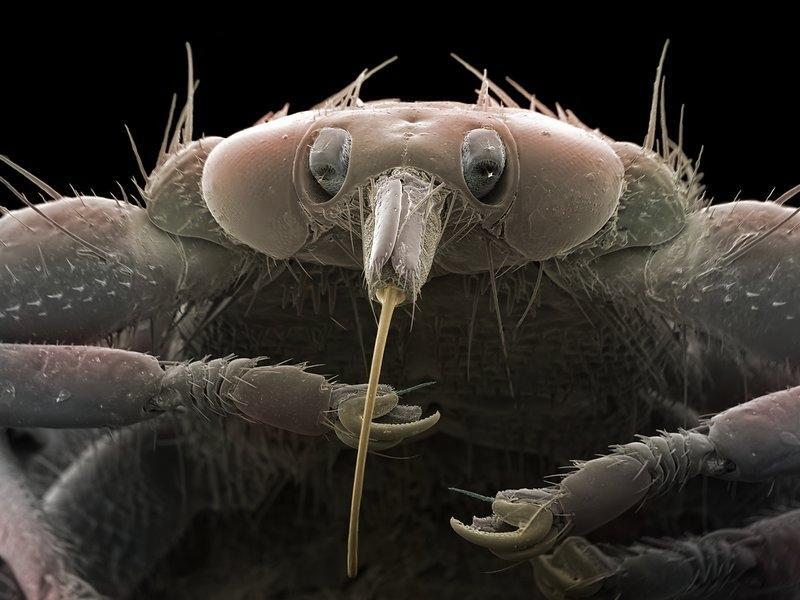 Deer bloodsucker (flying tick) under a microscope - My, Biology, Nauchpop, Research, The science, Longpost