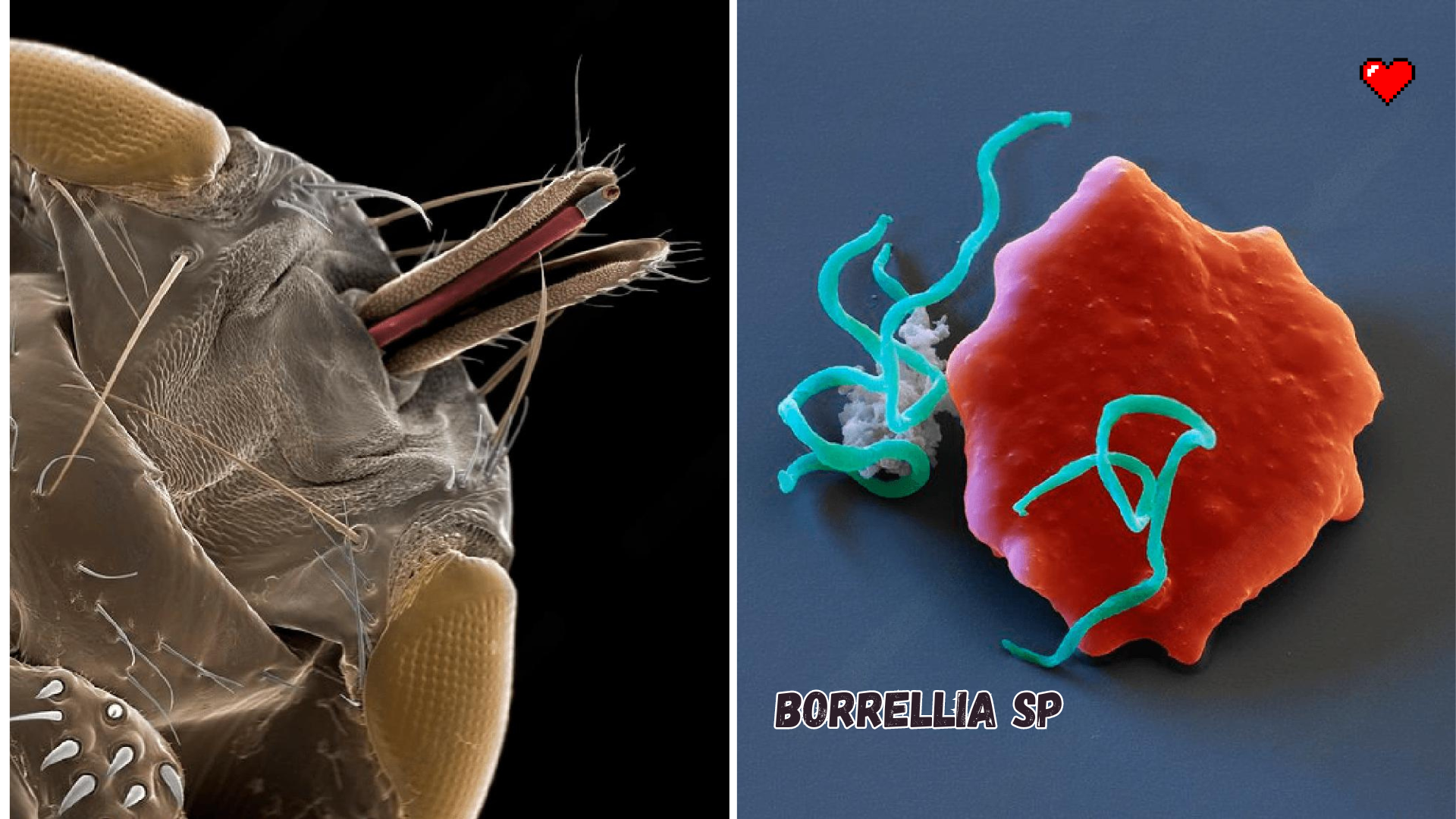 Deer bloodsucker (flying tick) under a microscope - My, Biology, Nauchpop, Research, The science, Longpost