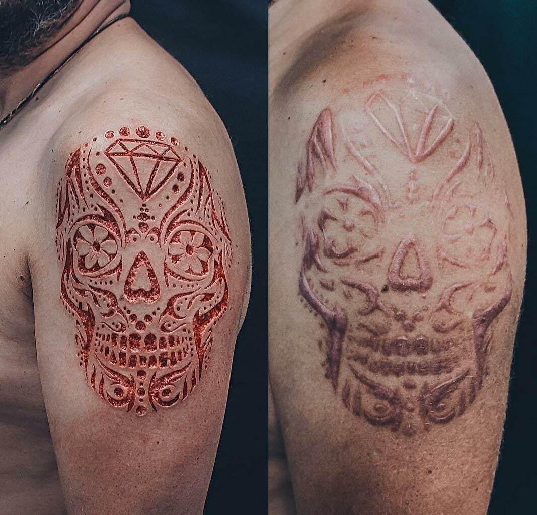 Шрамирование - старый-новый тренд в украшении тела | Пикабу