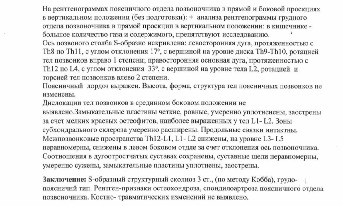 Сколиоз 3 степени. Дайте совет пожалуйста - Моё, Сколиоз, Спина, Операция, ЛФК, Позвоночник