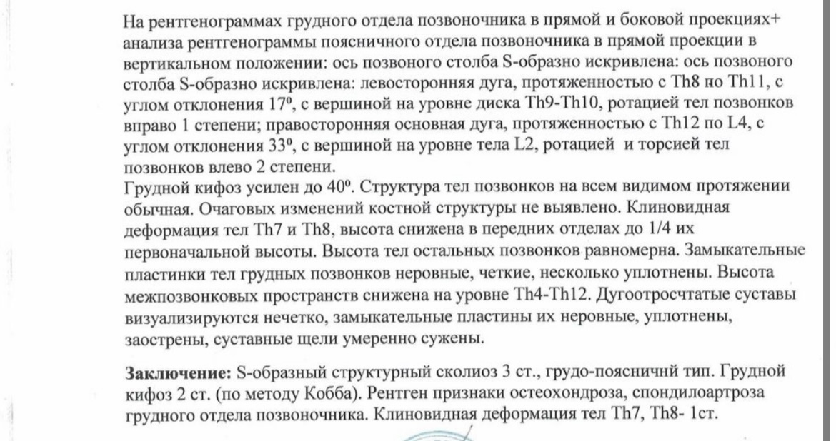 Сколиоз 3 степени. Дайте совет пожалуйста - Моё, Сколиоз, Спина, Операция, ЛФК, Позвоночник