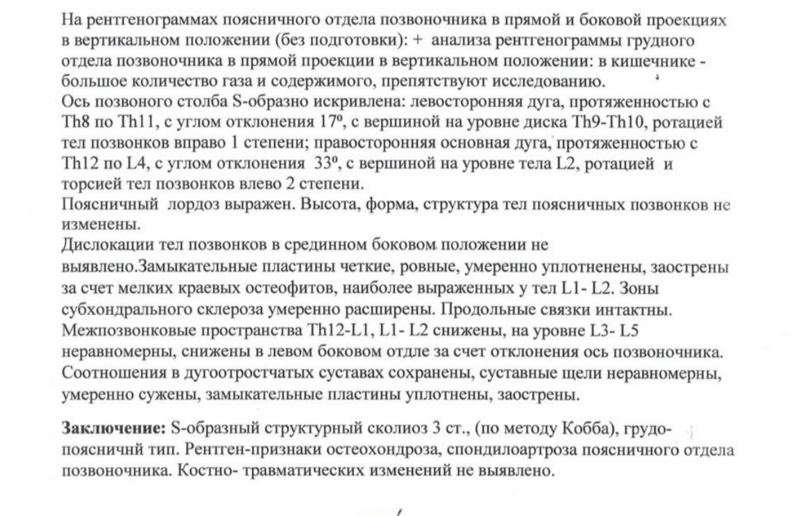 Сколиоз 3 степени. Дайте совет пожалуйста - Моё, Сколиоз, Спина, Операция, ЛФК, Позвоночник