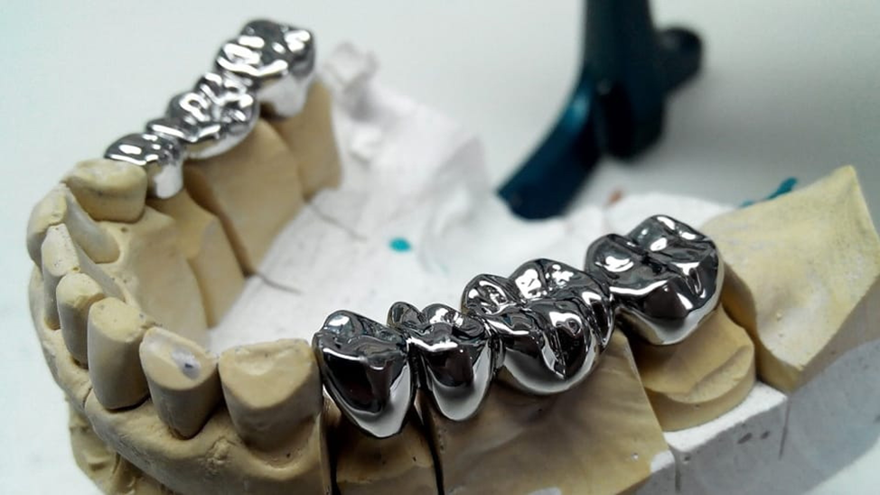 A saga about dentistry. Chapter 86. Which crowns are better? - My, Dentistry, Doctors, The medicine, Health, Answer, Crowns, Teeth, Prosthetics, Polyclinic, Treatment, Ceramics, Question, Material, Dentist, Choice, Longpost