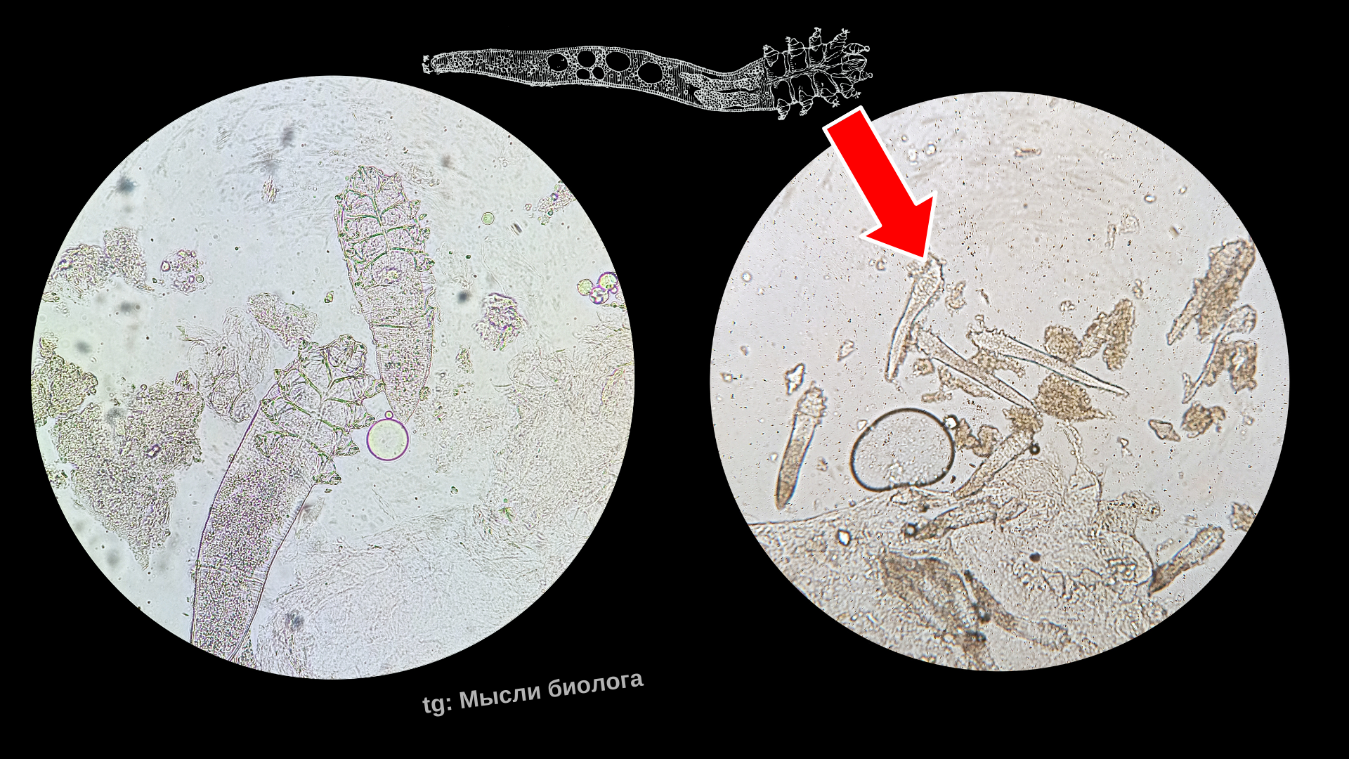 Are your eyes itchy? Perhaps it's eyelash mites - My, Biology, Nauchpop, Research, The science, Insects, Mite, Video, Youtube