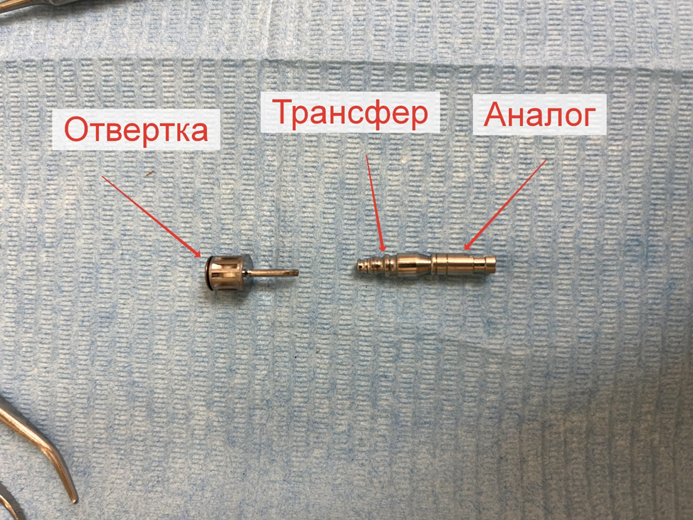 A saga about dentistry. Chapter 88. How to install a crown on a dental implant? - My, Dentistry, The medicine, Doctors, Health, Operation, Prosthesis, Crown, Teeth, Polyclinic, Implants, Dental implantation, Dentist, Ceramics, Spare parts, Question, Longpost