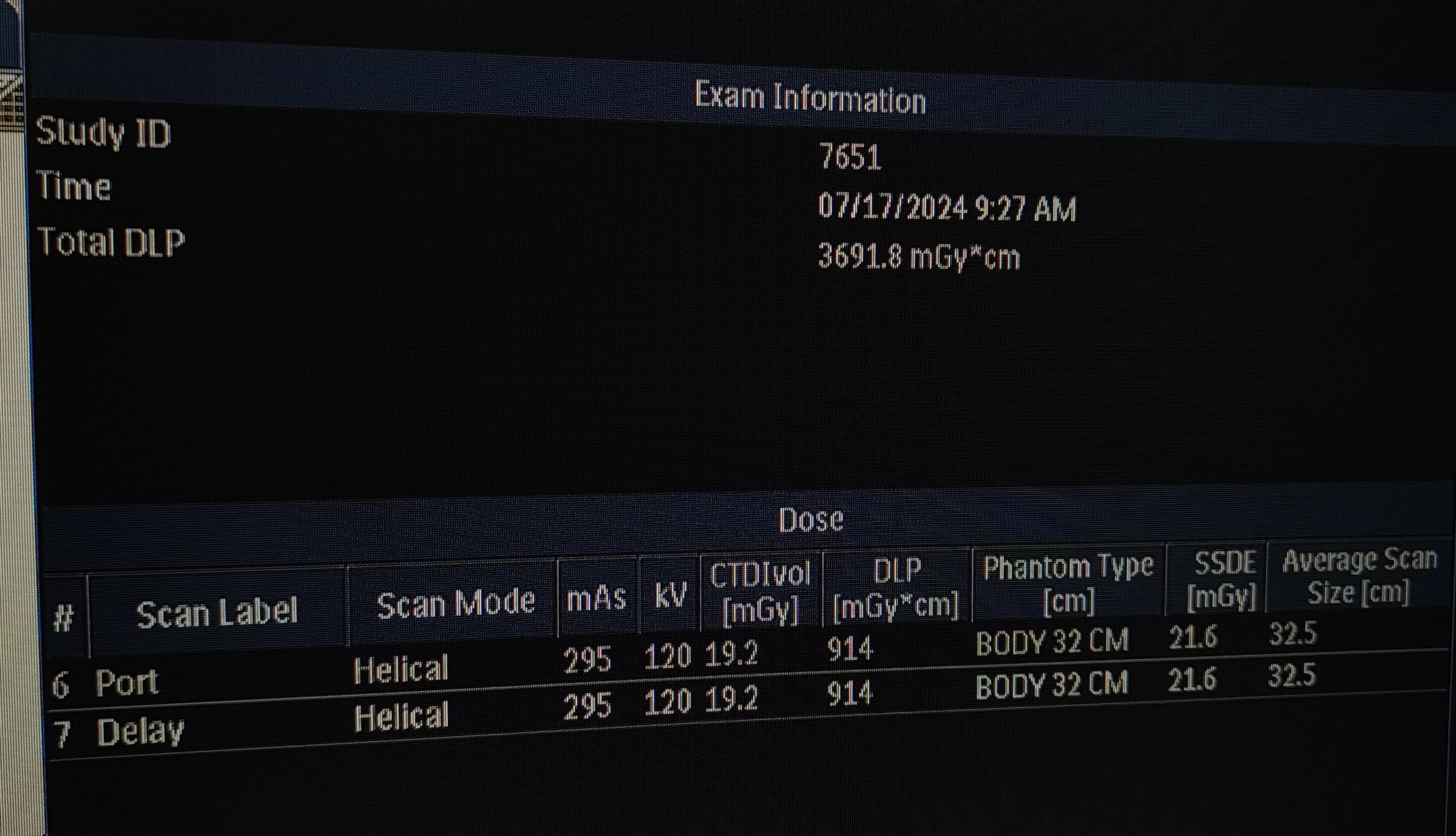 Philips irradiates - Work, Tomography, CT, Philips, X-radiation, Ionizing radiation, Question, Ask Peekaboo, Longpost