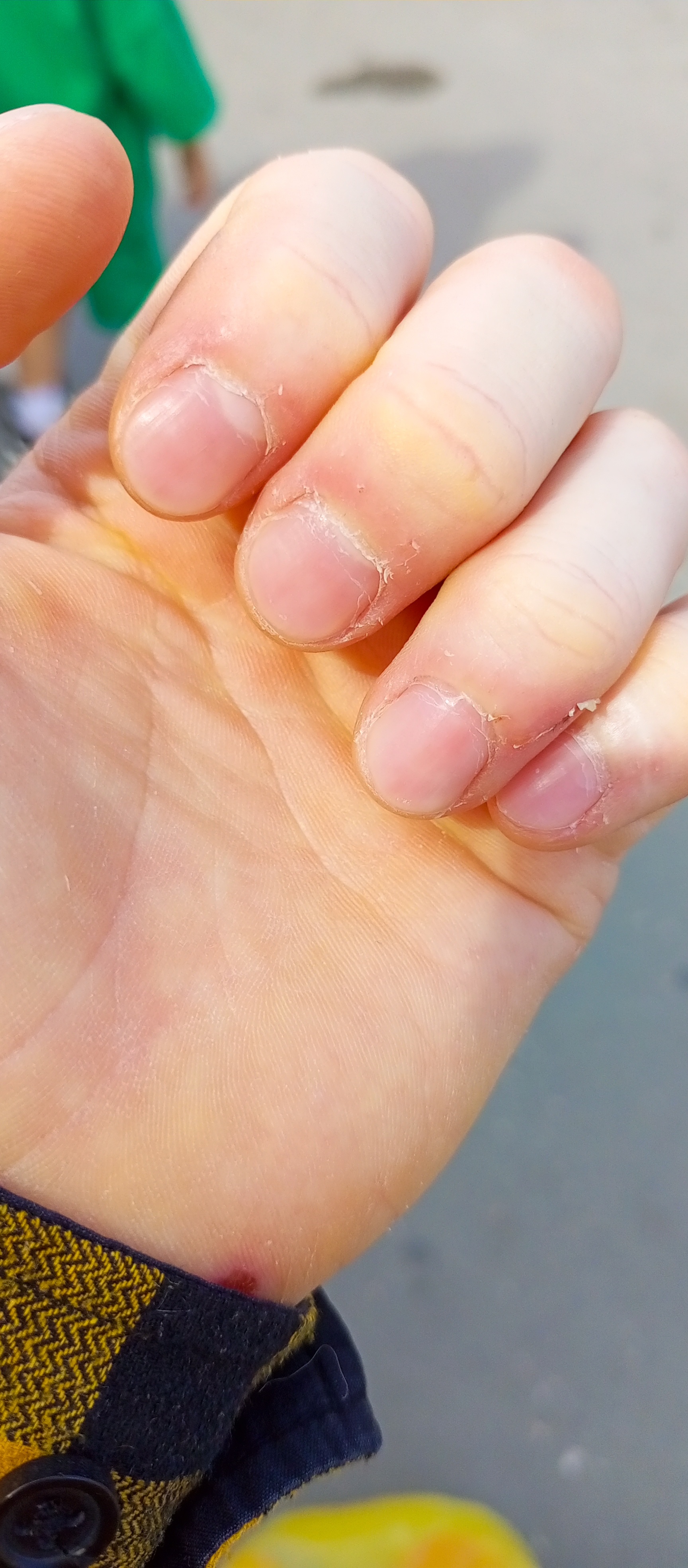 Fingers - My, Need advice, beauty, Fingers, Personal care, Longpost